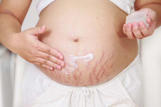 Prevenire le smagliature in gravidanza